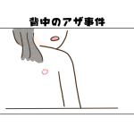 【日常】背中のアザ事件